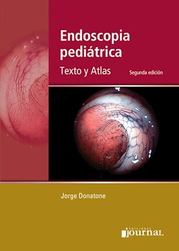 Endoscopía pediátrica