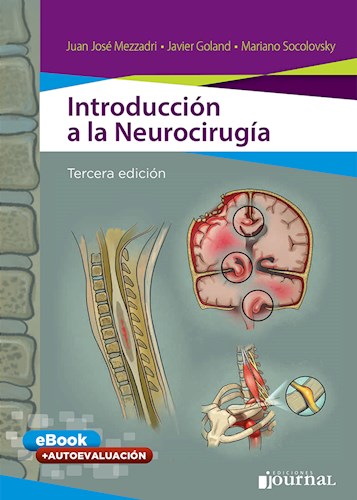 Introducción a la neurocirugía