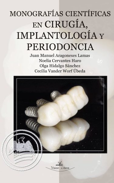 Monografías científicas en cirugía, implantología y periodoncia