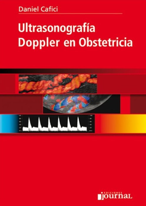 Ultrasonografía Doppler en obstetricia